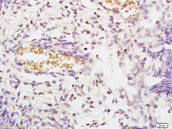 MST3/STK3 Rabbit Polyclonal Antibody