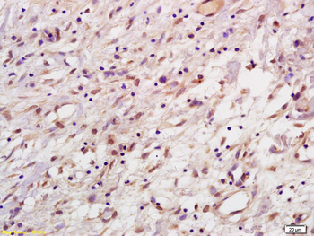 HPV33 E7 Rabbit Polyclonal Antibody
