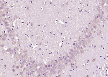 STK40 Rabbit Polyclonal Antibody
