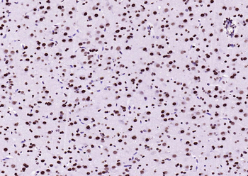 BRD7 Rabbit Polyclonal Antibody