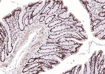 BRD7 Rabbit Polyclonal Antibody