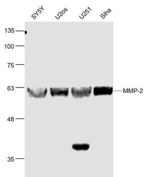 MMP-2 Rabbit Polyclonal Antibody