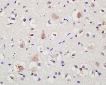 NTR3 Rabbit Polyclonal Antibody