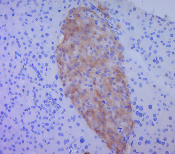 BMP4 Rabbit Polyclonal Antibody