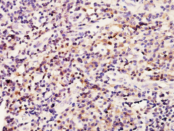 BRCA1 Rabbit Polyclonal Antibody