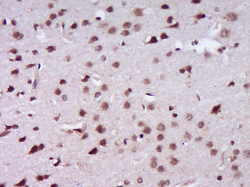 BRCA1 Rabbit Polyclonal Antibody