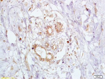 BRCA2 Rabbit Polyclonal Antibody