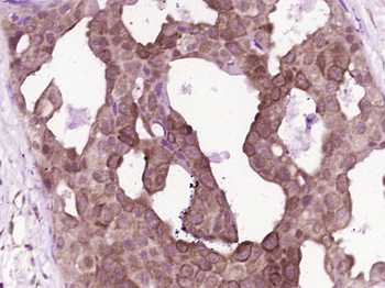 Calpain 2 Rabbit Polyclonal Antibody