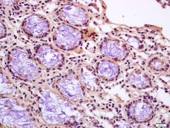 CNN1 Rabbit Polyclonal Antibody