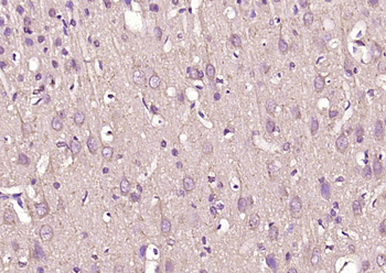 VAT1L Rabbit Polyclonal Antibody