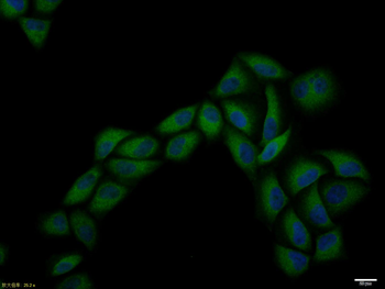 CCR7 Rabbit Polyclonal Antibody