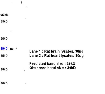 CXCR4 Rabbit Polyclonal Antibody