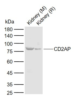 CD2AP Rabbit Polyclonal Antibody