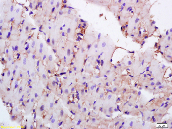 CD36 Rabbit Polyclonal Antibody