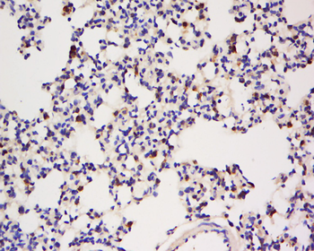 IGBP1 Rabbit Polyclonal Antibody