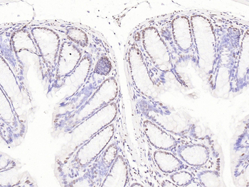 CDK1 Rabbit Polyclonal Antibody
