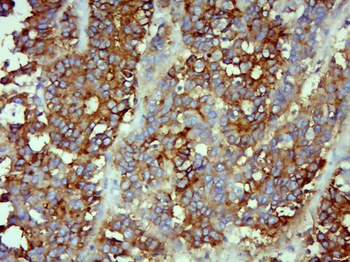 CEA Mouse Monoclonal Antibody