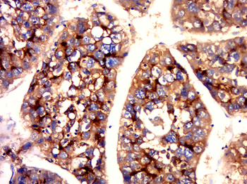 CEA Mouse Monoclonal Antibody