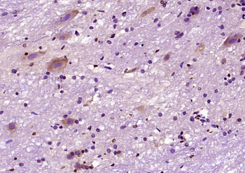 C-fos Rabbit Polyclonal Antibody