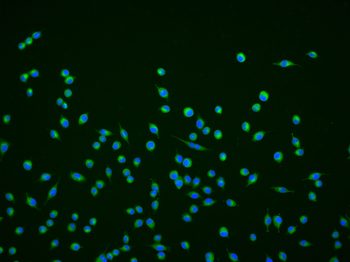 CHGA Rabbit Polyclonal Antibody