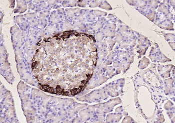 Chromogranin B Rabbit Polyclonal Antibody