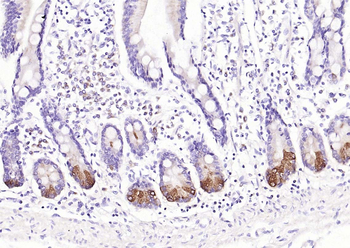 Chromogranin B Rabbit Polyclonal Antibody