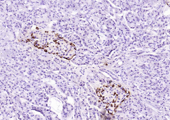Chromogranin B Rabbit Polyclonal Antibody