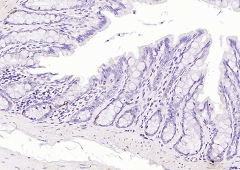 Chromogranin B Rabbit Polyclonal Antibody