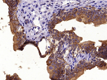 Pan Cytokeratin Rabbit Polyclonal Antibody