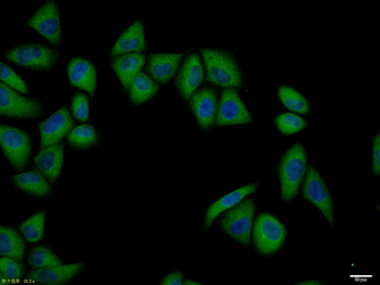 Pan Cytokeratin Rabbit Polyclonal Antibody