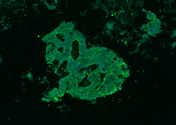 Pan Cytokeratin Rabbit Polyclonal Antibody