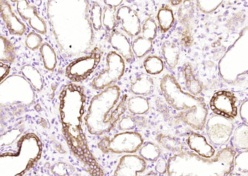 Pan Cytokeratin Rabbit Polyclonal Antibody