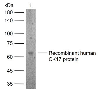 CK17 Rabbit Polyclonal Antibody