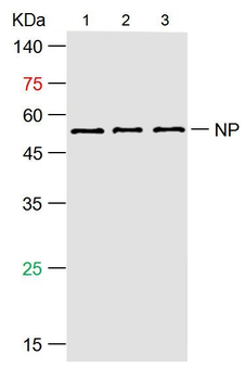 SARS-CoV-2 (2019-nCoV) Nucleocapsid, WT & Ormicron Recognized Recombinant Rabbit Monoclonal Antibody