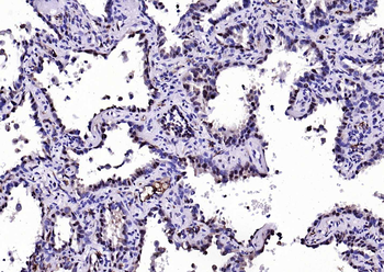 S100A8+A9 Complex Mouse Monoclonal Antibody