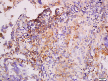 CK7 Rabbit Polyclonal Antibody