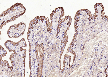 CK7 Rabbit Polyclonal Antibody