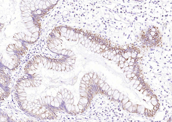 Cytokeratin 8 Rabbit Polyclonal Antibody