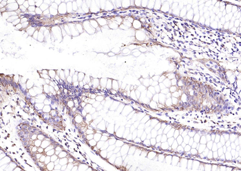 Cytokeratin 8 Rabbit Polyclonal Antibody
