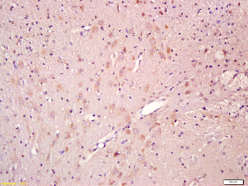 CNTF Rabbit Polyclonal Antibody