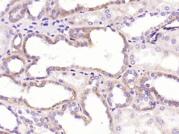 CRP Mouse Monoclonal Antibody