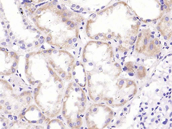 CRP Mouse Monoclonal Antibody