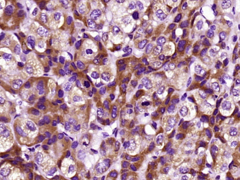 CRP Mouse Monoclonal Antibody