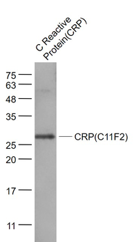 CRP Mouse Monoclonal Antibody