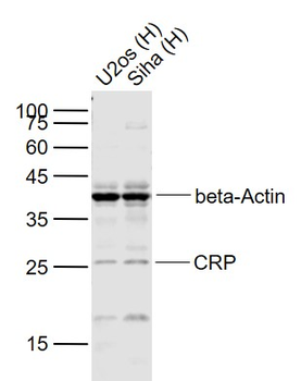 CRP Mouse Monoclonal Antibody