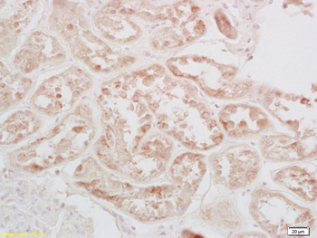 Phospho-CREB-1 (Ser133) Rabbit Polyclonal Antibody