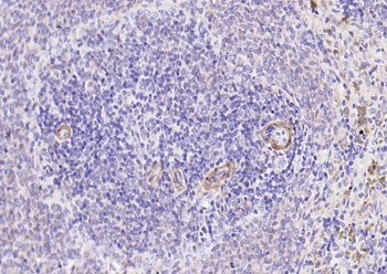 GP1BA Recombinant Rabbit Monoclonal Antibody
