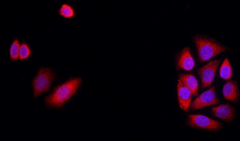 Connexin 43 Rabbit Polyclonal Antibody
