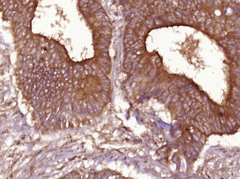 Cyclin D1 Rabbit Polyclonal Antibody