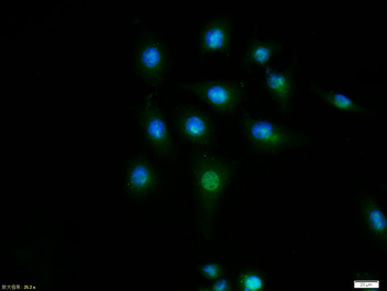 Cyclin D1 Rabbit Polyclonal Antibody